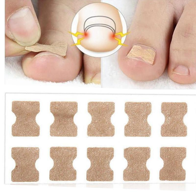 Пластир для корекції врослого нігтя EELHOE Toenail Correction Sticker 50 шт - зображення 2