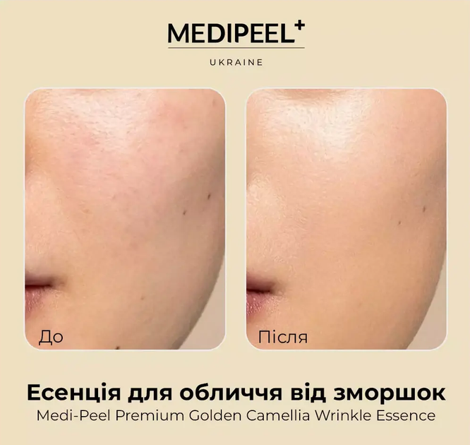 Эссенция для лица против морщин Medi-Peel Premium Golden Camellia Wrinkle Essence, 50 мл - изображение 4