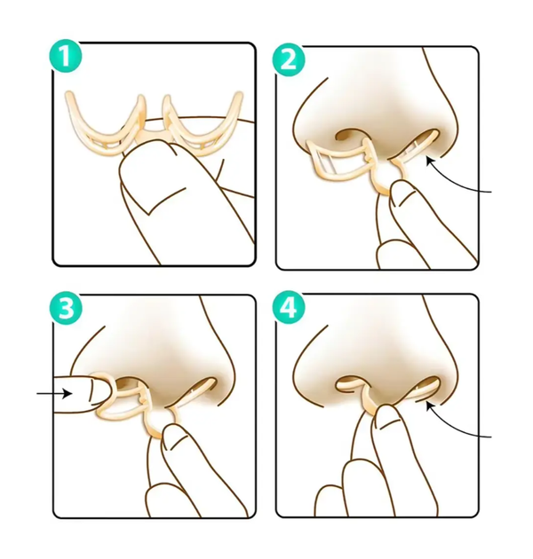 Назальний розширювач антихрап SPORT Intra Nasal Breathe Aid - изображение 6