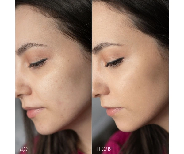 Професійний кушон зі SMART-пігментами Хедісон, що адаптується до теплого відтінку шкіри, Dr. HEDISON Miracle SPF 50/PA+++ , 15 г + 15 г (змінний блок) (12300002) - зображення 3