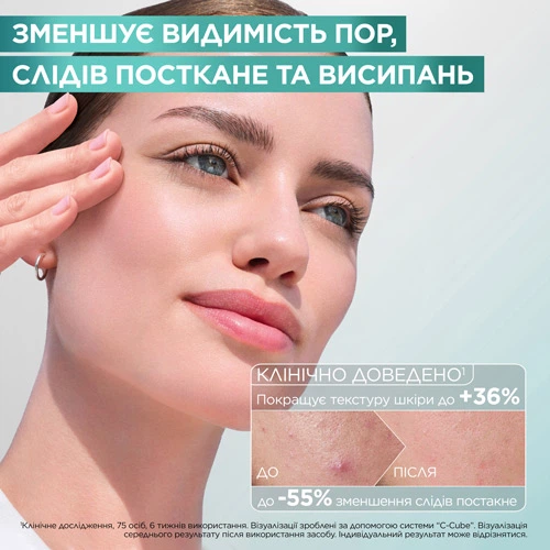 Эссенция-пилинг Garnier Pure Active с салициловой кислотой для уменьшения видимости следов несовершенств 120 мл (3600542628631) - Фото 4 Эссенция-пилинг Garnier Pure Active с салициловой кислотой для уменьшения видимости следов несовершенств 120 мл (3600542628631) - изображение 4