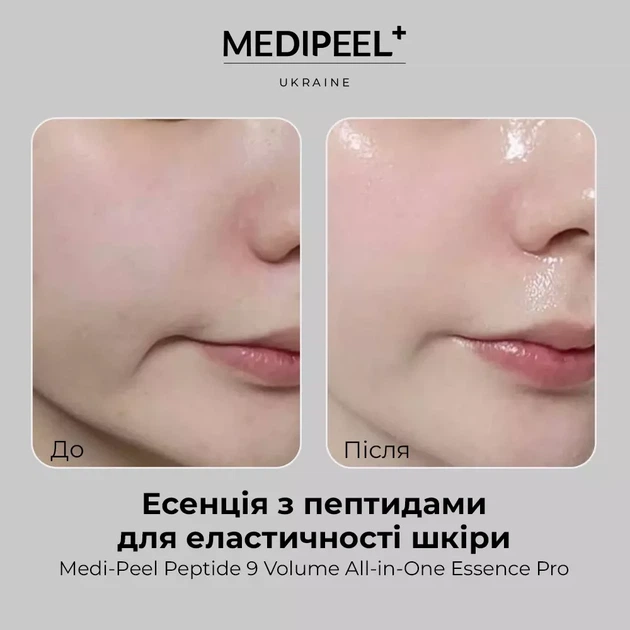 Киснева есенція Medi Peel Peptide 9 Volume All-in-One Essence Pro, 100 мл - Фото 4 Киснева есенція Medi Peel Peptide 9 Volume All-in-One Essence Pro, 100 мл - зображення 4