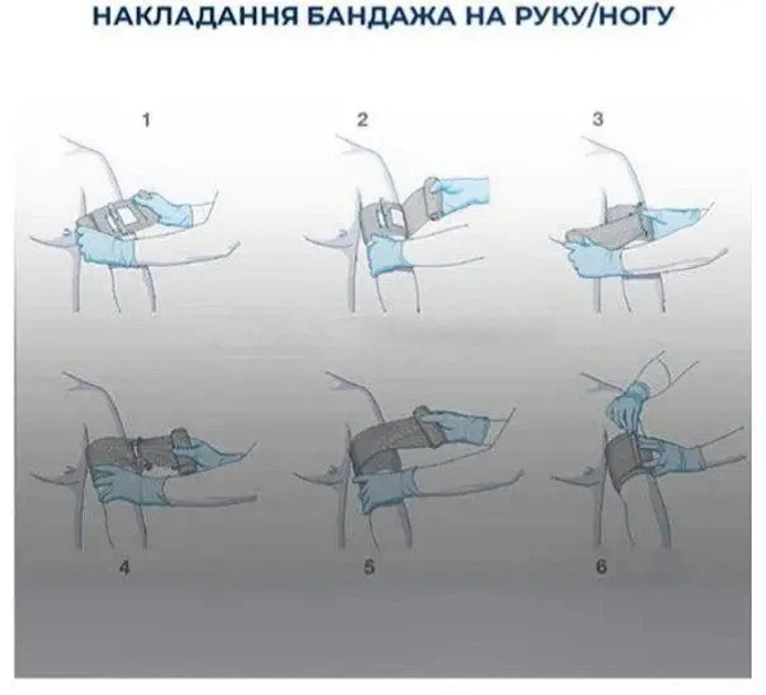 Бандаж Sісn ізраїльський 6" SІЧ з фіксуючою скобою - зображення 7