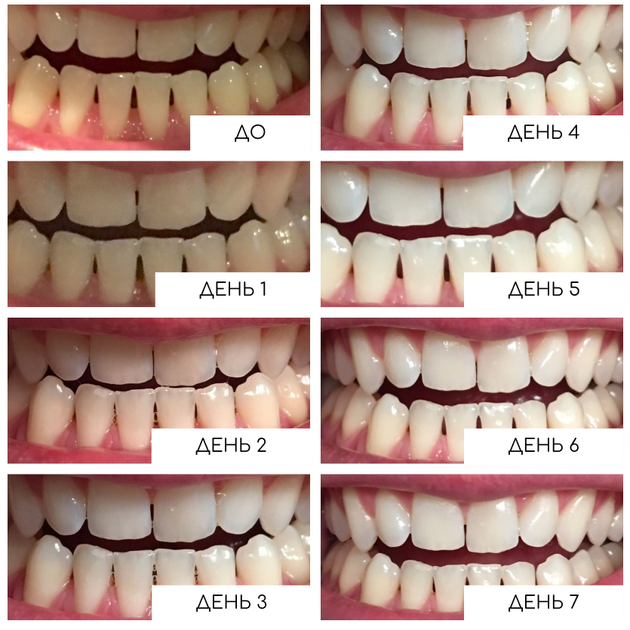 Відбілювальні смужки Medica+ 3DWhite Strips - зображення 7