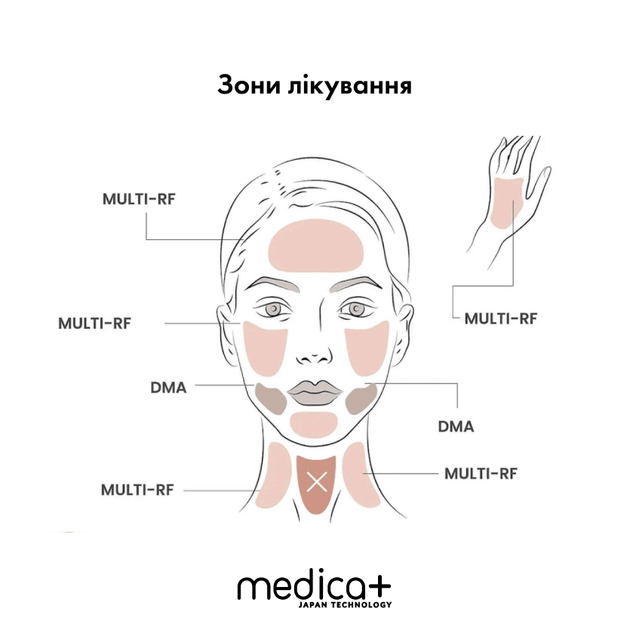 Мікрострумовий RF Lifting Масажер для обличчя Skin Lifting 7.0 Pink - EMS, LED - зображення 11