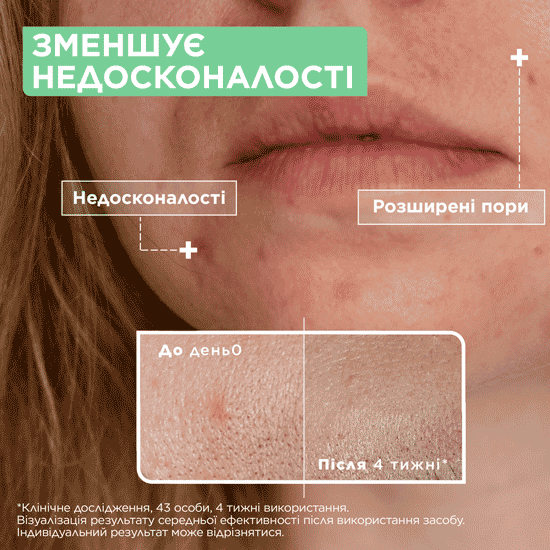 Сыворотка Mixa с Салициловой кислотой и Ниацинамидом 30 мл (3600551136967) - Фото 3 Сыворотка Mixa с Салициловой кислотой и Ниацинамидом 30 мл (3600551136967) - изображение 3