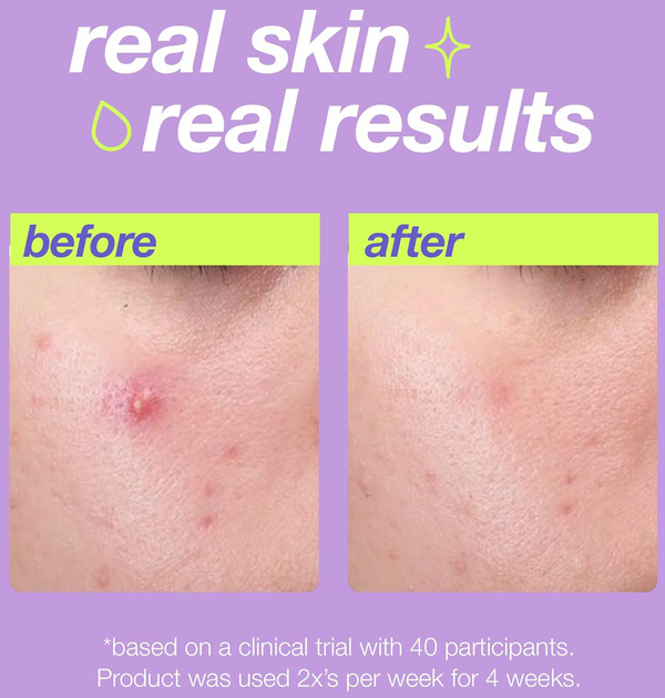 Peeling do twarzy Dermalogica Clear Start Glycerin oczyszczający 30 ml (666151113282) - obraz 5