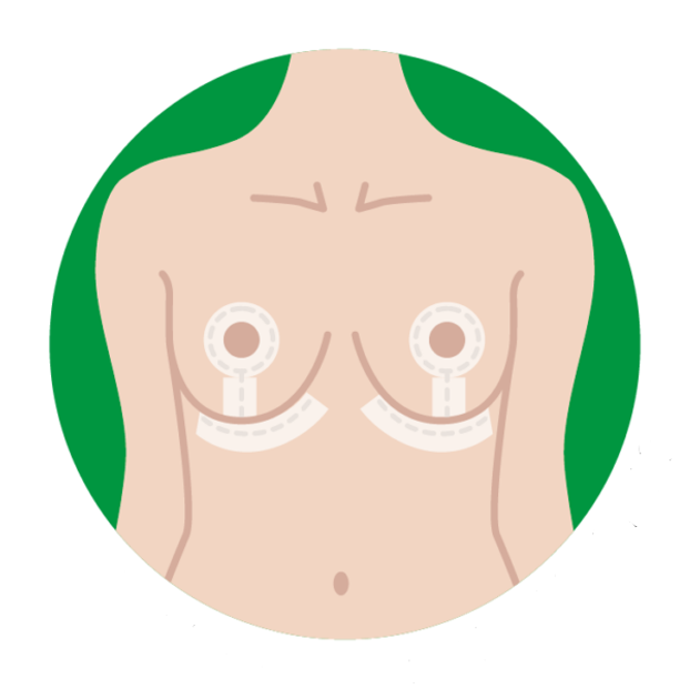 Силіконові ліфтинг-пластирі для грудей Improscar Patch Breast Lift - зображення 2