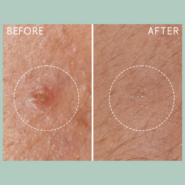 Koncentrat do twarzy Lierac Protocols Anti-Blemish The Stop Spots przeciw niedoskonałościom skóry 15 ml (3701436926229) - obraz 3