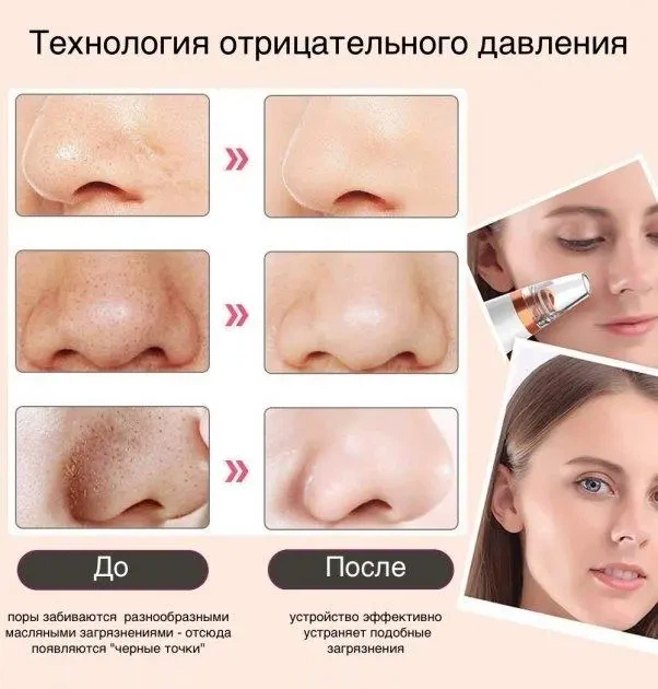 Вакуумний очищувач шкіри та пор Multi-Functional для чищення обличчя видаляє вугри та акне покращує циркуляцію крові - зображення 3
