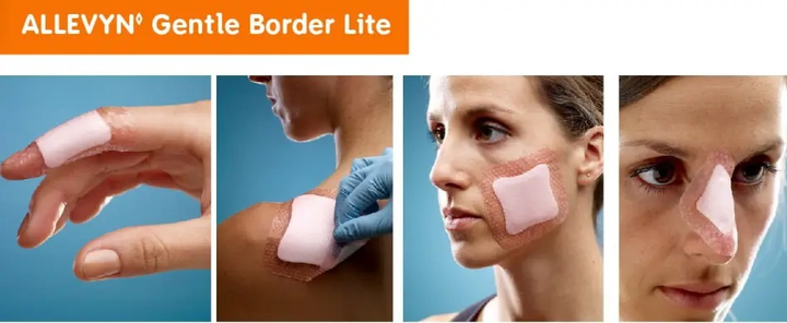 Силіконовий пластир проти пролежнів ALLEVYN gentle border 7.5х7.5см 3in3in №1 - зображення 2