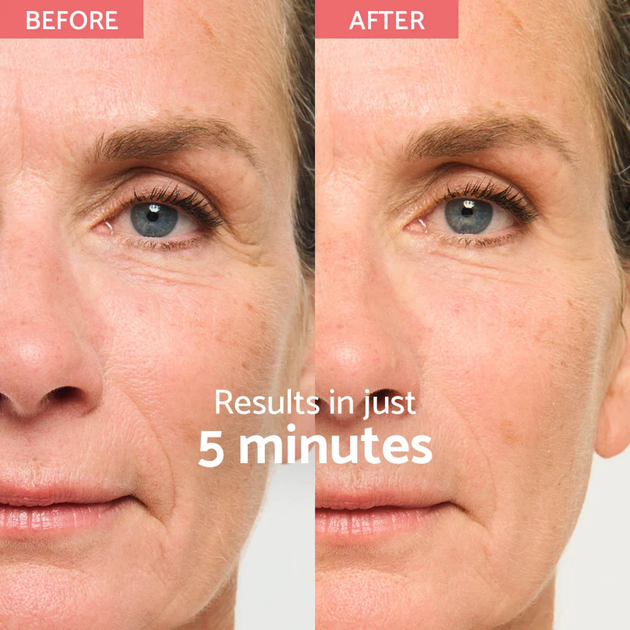 Крем для обличчя Remescar Instant Facelift 40 мл (5425012537248) - зображення 2
