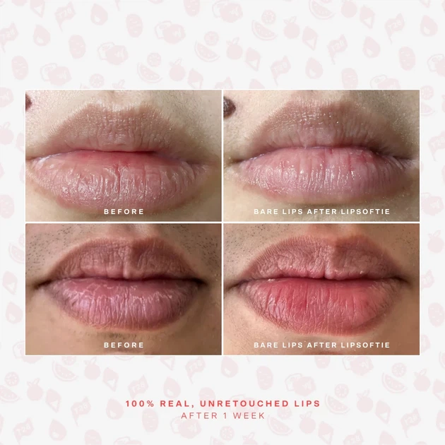 Пептидный бальзам для губ TOWER 28 Confetti Cake LipSoftie™ Lip Treatment - Фото 6 Пептидный бальзам для губ TOWER 28 Confetti Cake LipSoftie™ Lip Treatment - изображение 6