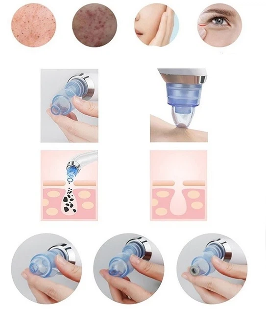 Вакуумный аппарат для чистки пор Derma Suction White 100 3 режима работы 4 насадки - изображение 3