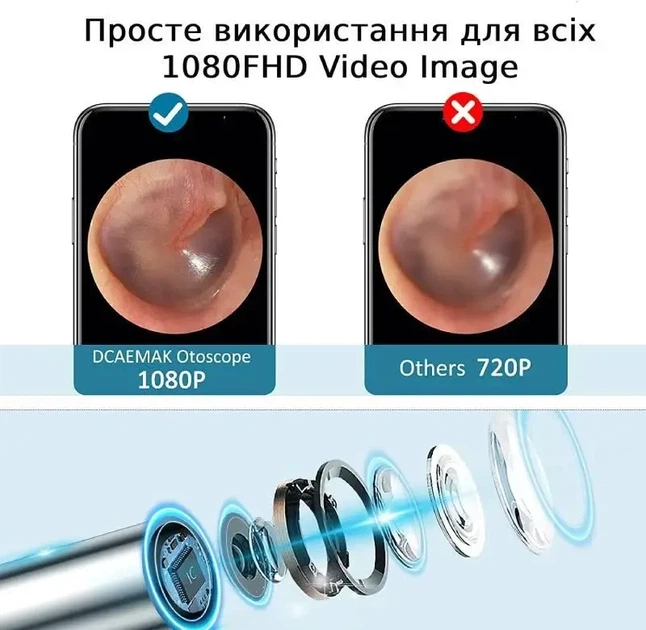 Отоскоп аккумуляторный DCAEMAK Р50, с камерой для детального обзора и эффективного удаления серы, белый - изображение 4