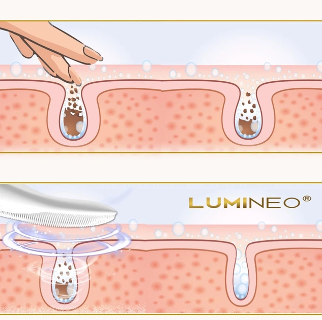 Szczoteczka do twarzy Lumineo Sonic perłowa + żel do skóry problematycznej (5904726872741) - obraz 12