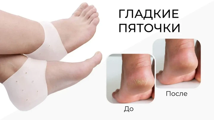 Протектор на пятку для взрослых Valgus Pro with hole 2шт White (16375) - Фото 8 Протектор на пятку для взрослых Valgus Pro with hole 2шт White (16375) - изображение 8