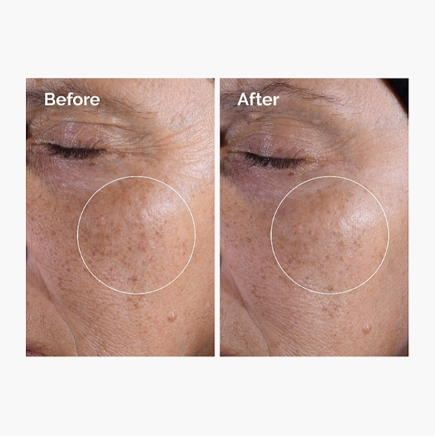 Toner do twarzy The Ordinary Glycolic Acid 7% z kwasem glikolowym 240 ml (769915234060) - obraz 4