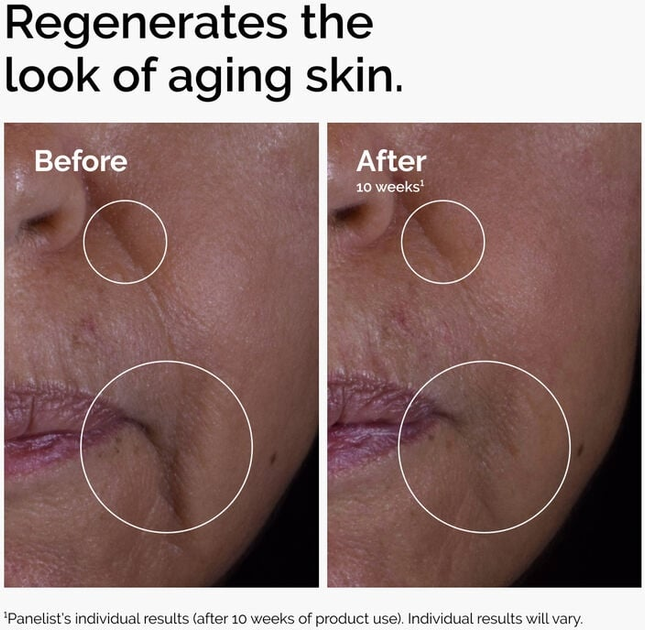 Сироватка для обличчя The Ordinary Growth Factors 15% Solution антивікова 30 мл (769915234411) - зображення 5