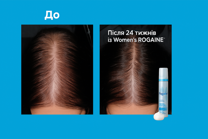 Піна для волосся Women's ROGAINE 5% Minoxidil Unscented Foam 2 флакони - зображення 8