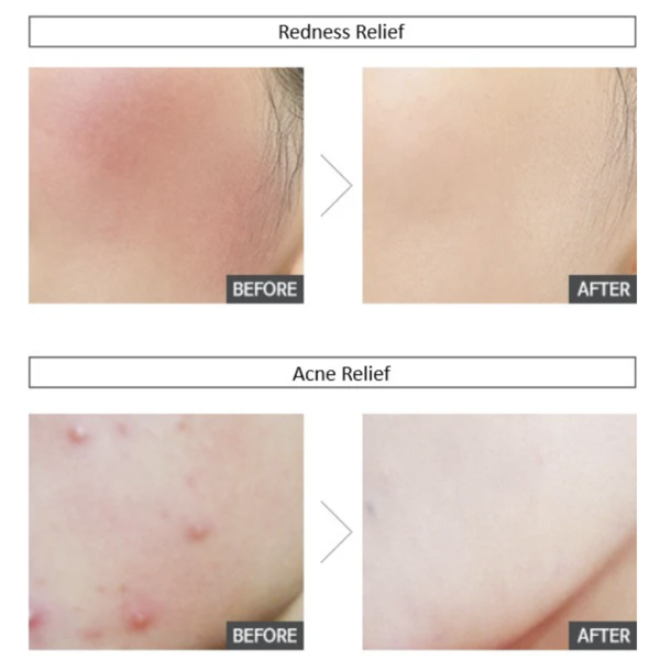 Заспокійливий крем Sur.Medic+ Azulene Soothing Cream з азуленом 50 мл - зображення 6