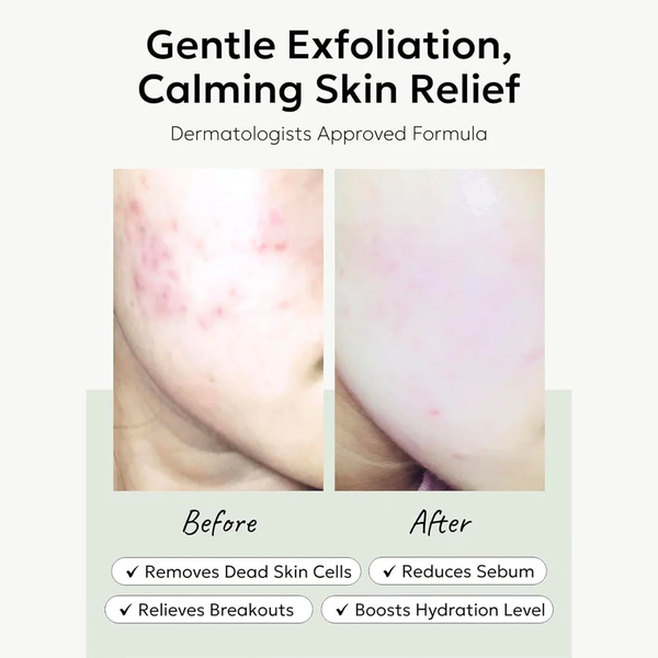 Пилинг-пэды Celimax Ji Woo Gae Heartleaf BHA Peeling Pad отшелушивающие с BHA кислотами 125 мл 60 шт - Фото 5 Пилинг-пэды Celimax Ji Woo Gae Heartleaf BHA Peeling Pad отшелушивающие с BHA кислотами 125 мл 60 шт - изображение 5