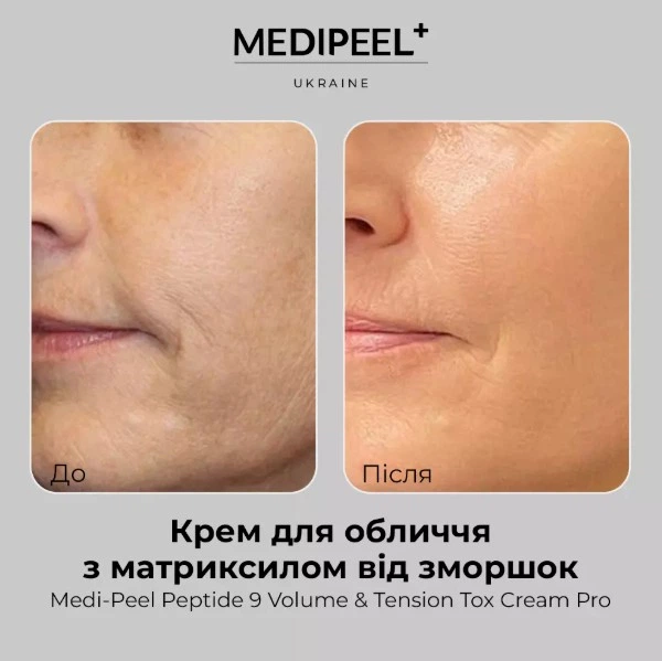 Антивіковий крем на основі волюфіліну та пептидів MEDI PEEL PEPTIDE 9 VOLUME AND TENSION TOX CREAM PRO 50 мл - изображение 3