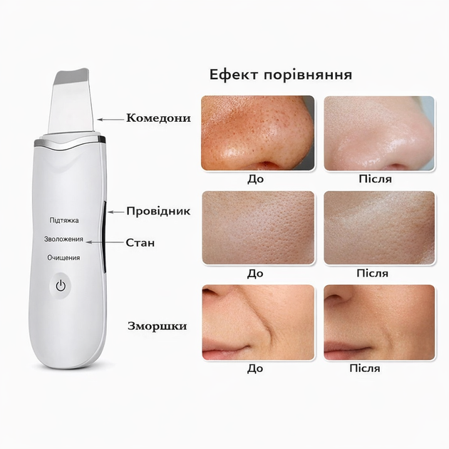 Ультразвуковой скрабер для лица Beauty Skin S1 White (белый) – прибор для глубокого очищения, лифтинга и фонофореза, салонный - Фото 4 Ультразвуковой скрабер для лица Beauty Skin S1 White (белый) – прибор для глубокого очищения, лифтинга и фонофореза, салонный - изображение 4