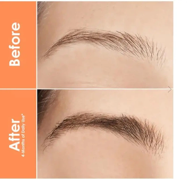Сыворотка для роста бровей Grande cosmetics Grandebrow brow enhancing serum - Фото 2 Сыворотка для роста бровей Grande cosmetics Grandebrow brow enhancing serum - изображение 2