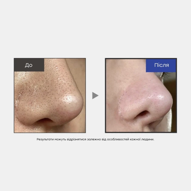 MEDICUBE One Day Exosome Shot Pore Ampoule 2000 Сыворотка с экзосомами и спикулами для сужения пор 2000 - изображение 4
