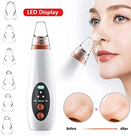 Апарат для глибокого вакуумного чищення пор обличчя Dermal Multi-Functional Cleaning - зображення 2