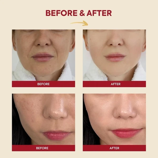 Есенція K-Secret Seoul 1988 Essence Snail Mucin 97% + Rice 100 мл - зображення 4