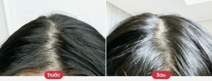 Пілінг для шкіри голови із сіллю мертвого моря Dr.Forhair Sea Salt Scaler 300 г - зображення 4