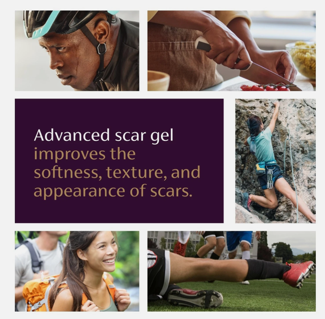 Медерма Німеччина 20 г Mederma Advanced Scar Gel мазь від шрамів, крем від рубців, гель від шрамів - зображення 6