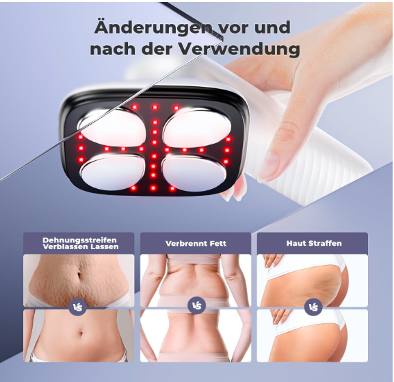 Массажер от целлюлита Cellulite Massager F5 Машина для моделирования тела 4 в 1 - Б/У - Фото 7 Массажер от целлюлита Cellulite Massager F5 Машина для моделирования тела 4 в 1 - Б/У - изображение 7