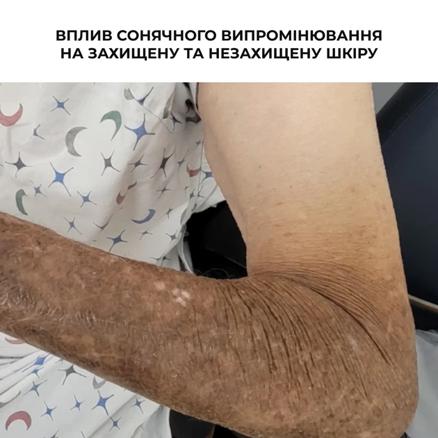 Комплекс для борьбы с акне на теле SPF 50+ салициловая кислота 4 шт - изображение 11