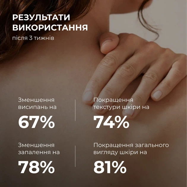 Комплекс для борьбы с акне на теле SPF 50+ салициловая кислота 4 шт - изображение 5