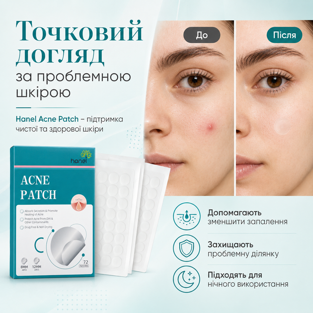 Патчи для лица от прыщей Acne Patch Уход за проблемной кожей 72 шт/1 уп Анти-акне Патчи для лица от прыщей - изображение 8