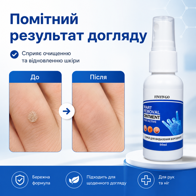 Удаление мозолей Fivfivgo Wart Removal Ointment Удаление бородавки быстро и эффективно дома 50 мл Удаление бородавок - изображение 7