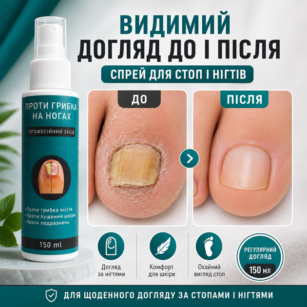 Средство от грибка Fungi Stop Стоп Грибок ногтей 150 мл Спрей против грибка и потливости ног Грибок ногтей - изображение 9