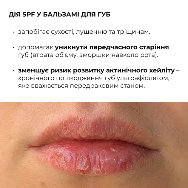 Комплекс для щоденного SPF захисту губ та обличчя 30 мл SPF 30 олія авокадо, вітамін Е - зображення 7