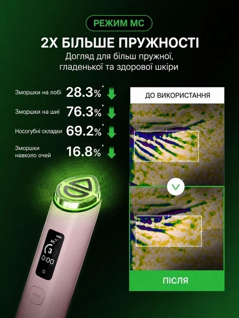 Многофункциональное устройство для домашнего ухода за кожей Medicube AGE-R Booster Pro X2 White - изображение 3