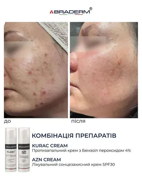 Противовоспалительный крем BRADERM Kurac Cream, 30 мл 00-00000386 - изображение 4