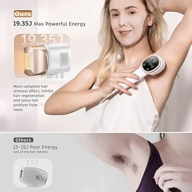 IPL фотоэпилятор Aopvui - изображение 5