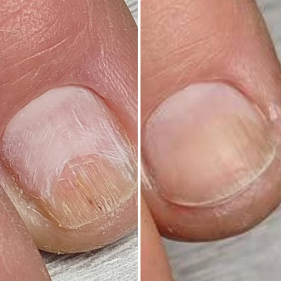 Рeгенерирующий лосьон для ногтей Onistopix Lotion, 15 мл - изображение 4