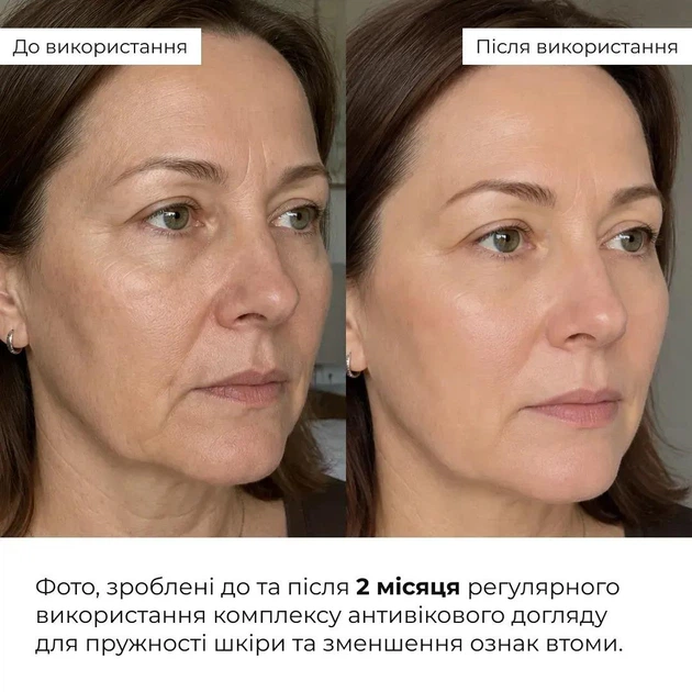 Комплекс антивозрастного ухода для упругости кожи и уменьшение признаков усталости Пенка, Тонер, Крем гель HiLLARY K-11-676 - Фото 2 Комплекс антивозрастного ухода для упругости кожи и уменьшение признаков усталости Пенка, Тонер, Крем гель HiLLARY K-11-676 - изображение 2