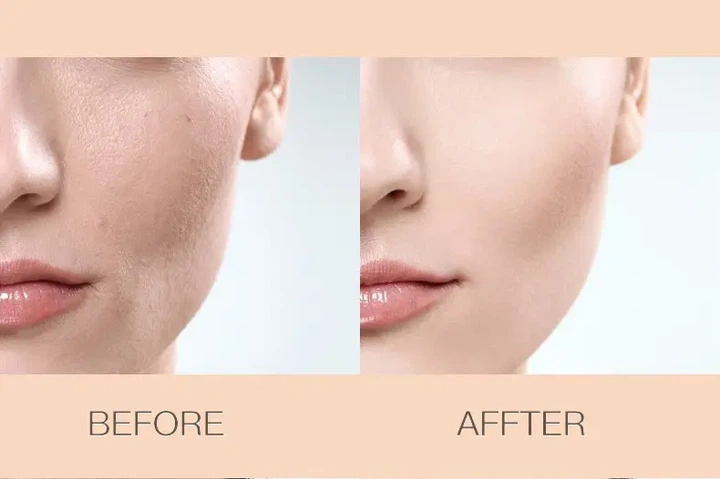 Кушон для лица Veze Clear Cover Beauty Cream натуральный тон 01 20 мл тональный крем для сухой кожи увлажняющее средство маскировки покраснений высыпаний шелушения выравнивания цвета - Фото 6 Кушон для лица Veze Clear Cover Beauty Cream натуральный тон 01 20 мл тональный крем для сухой кожи увлажняющее средство маскировки покраснений высыпаний шелушения выравнивания цвета - изображение 6