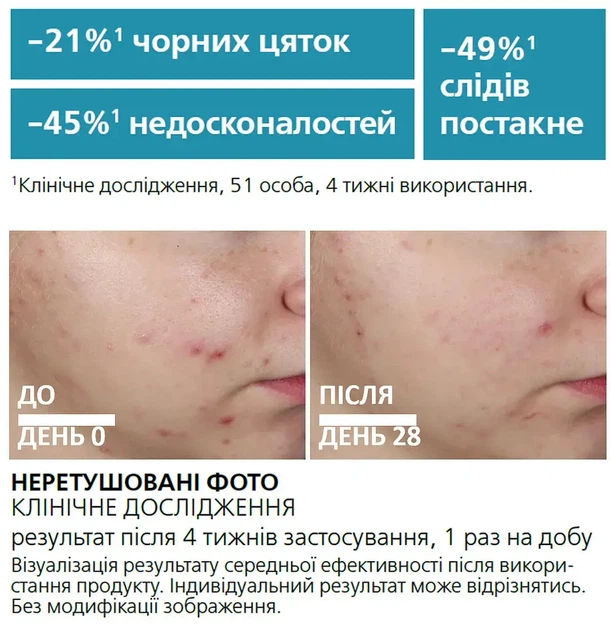 Ультраконцентрированная сыворотка для лица La Roche-Posay Effaclar Serum с эффектом пилинга, 30 мл - изображение 4