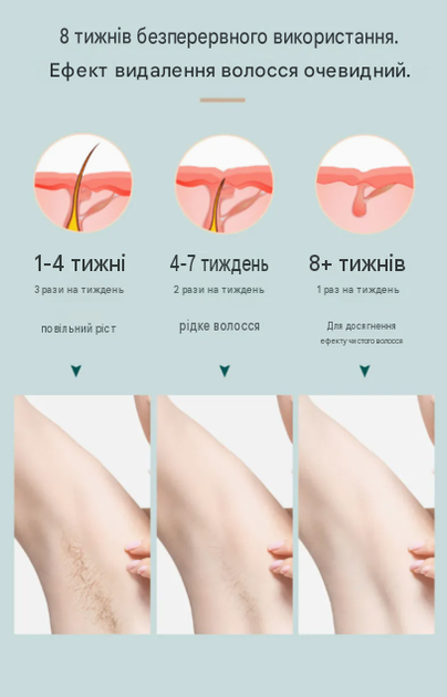 IPL фотоэпилятор AI-17 Ice Cool с охлаждением, 9 уровней мощности, 600 000 вспышек, 4 см2, белый / розовое золото - изображение 3