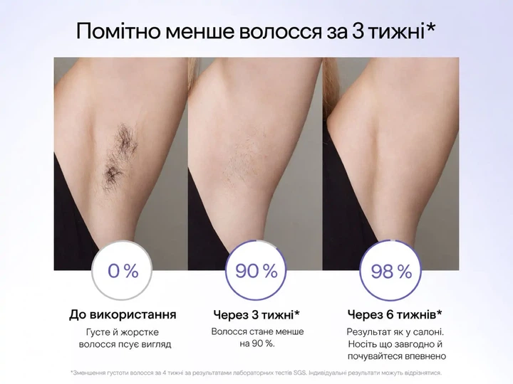 Фотоэпилятор ULIKE Air 3 IPL Lavander с охлаждением Sapphire Ice Cooling для безболезненной эпиляции - Фото 3 Фотоэпилятор ULIKE Air 3 IPL Lavander с охлаждением Sapphire Ice Cooling для безболезненной эпиляции - изображение 3